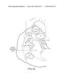 MAGNETIC NAVIGATION SYSTEMS AND METHODS diagram and image