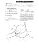 MEDICAL DEVICE FOR TISSUE ABLATION AND RELATED METHODS OF USE diagram and image