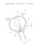 MEDICAL DEVICE FOR TISSUE ABLATION AND RELATED METHODS OF USE diagram and image