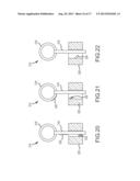 METHOD AND SYSTEM FOR LIGATING A BODY PART diagram and image