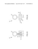 METHOD AND SYSTEM FOR LIGATING A BODY PART diagram and image