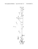 Pediatric Esophageal Atresia Magnetic Anastomosis System diagram and image