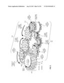 MINIATURE SHREDDING TOOL FOR USE IN MEDICAL APPLICATIONS AND METHODS FOR     MAKING diagram and image