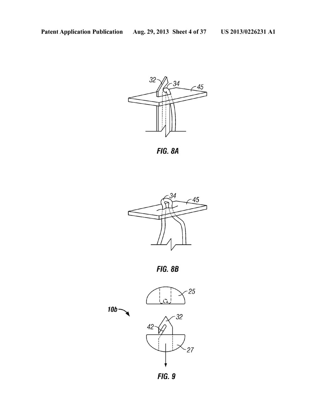 Suturing Apparatus and Method - diagram, schematic, and image 05