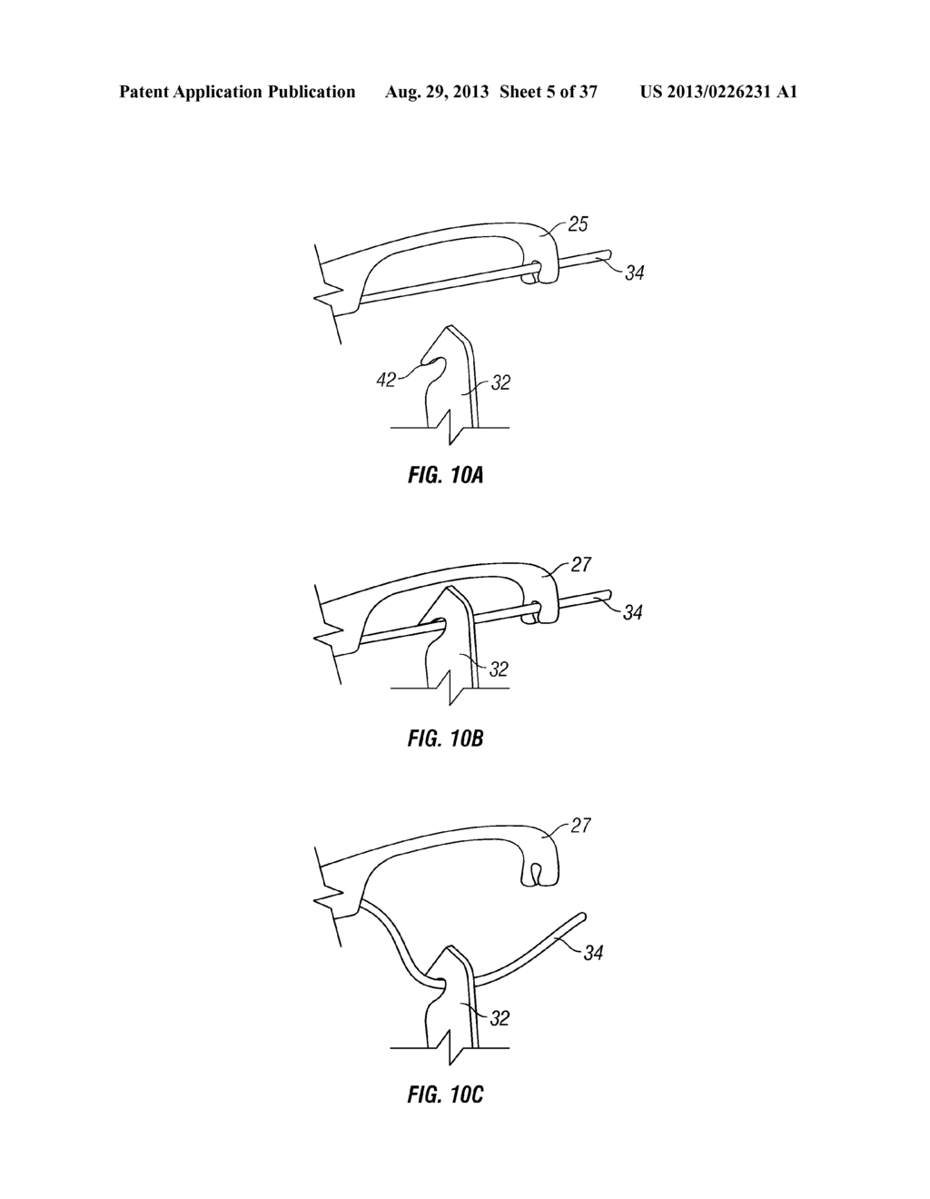 Suturing Apparatus and Method - diagram, schematic, and image 06