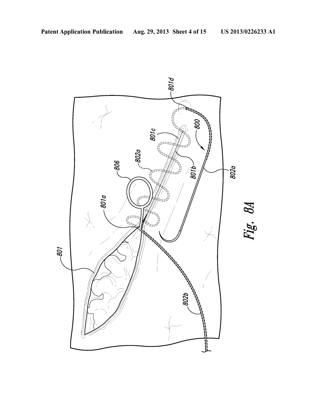 EMERGENCY SELF-RETAINING SUTURES AND PACKAGING - diagram, schematic, and image 05