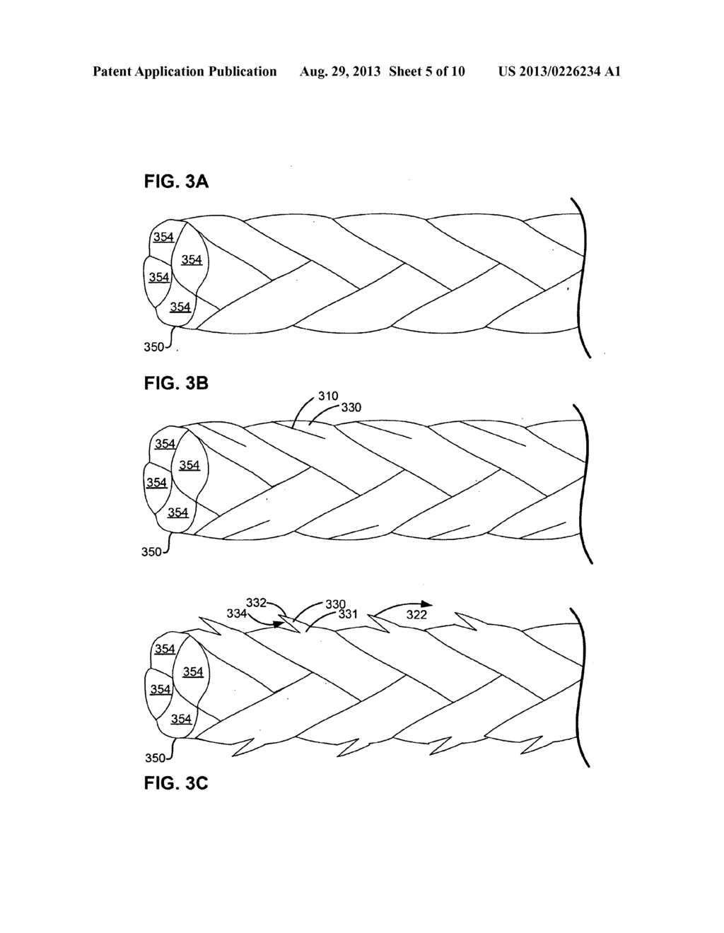 BRAIDED SELF-RETAINING SUTURES AND METHODS - diagram, schematic, and image 06