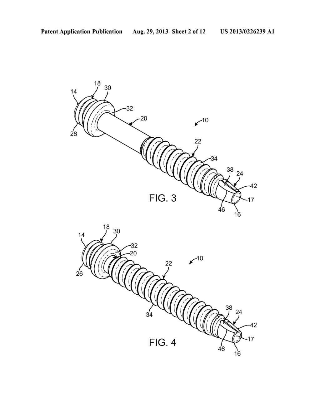 Facet screw and method for spinal stabilization - diagram, schematic, and image 03