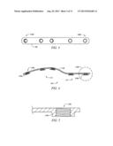 Locking Plate with Screw Fixation from Opposite Cortex diagram and image