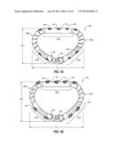 PERCUTANEOUS ANNULOPLASTY SYSTEM WITH ANTERIOR-POSTERIOR ADJUSTMENT diagram and image