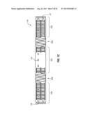 PERCUTANEOUS ANNULOPLASTY SYSTEM WITH ANTERIOR-POSTERIOR ADJUSTMENT diagram and image