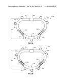 PERCUTANEOUS ANNULOPLASTY SYSTEM WITH ANTERIOR-POSTERIOR ADJUSTMENT diagram and image