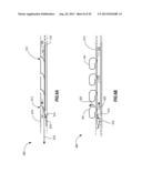 PERCUTANEOUS ANNULOPLASTY SYSTEM WITH ANTERIOR-POSTERIOR ADJUSTMENT diagram and image