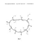 PERCUTANEOUS ANNULOPLASTY SYSTEM WITH ANTERIOR-POSTERIOR ADJUSTMENT diagram and image