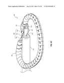 PERCUTANEOUS ANNULOPLASTY SYSTEM WITH ANTERIOR-POSTERIOR ADJUSTMENT diagram and image