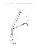 PERCUTANEOUS ANNULOPLASTY SYSTEM WITH ANTERIOR-POSTERIOR ADJUSTMENT diagram and image