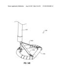 PERCUTANEOUS ANNULOPLASTY SYSTEM WITH ANTERIOR-POSTERIOR ADJUSTMENT diagram and image