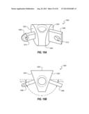 PERCUTANEOUS ANNULOPLASTY SYSTEM WITH ANTERIOR-POSTERIOR ADJUSTMENT diagram and image