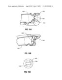 PERCUTANEOUS ANNULOPLASTY SYSTEM WITH ANTERIOR-POSTERIOR ADJUSTMENT diagram and image