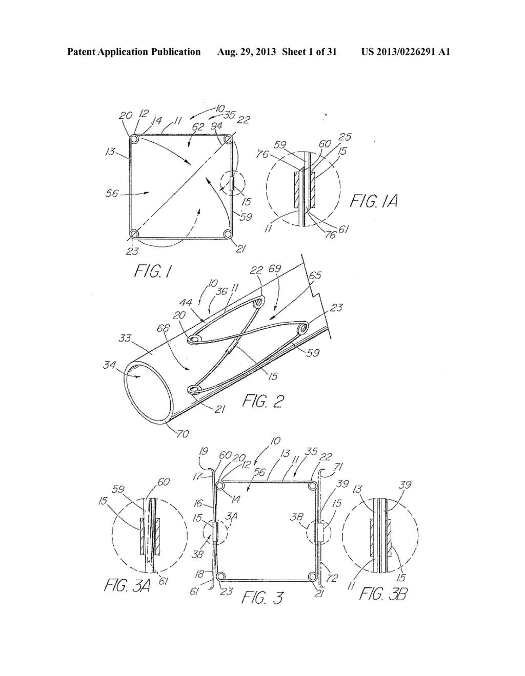 IMPLANTABLE VASCULAR DEVICE - diagram, schematic, and image 02