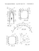 IMPLANTABLE VASCULAR DEVICE diagram and image