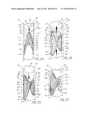 IMPLANTABLE VASCULAR DEVICE diagram and image