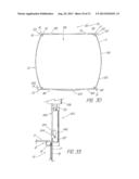 IMPLANTABLE VASCULAR DEVICE diagram and image