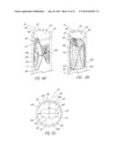 IMPLANTABLE VASCULAR DEVICE diagram and image