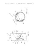 IMPLANTABLE VASCULAR DEVICE diagram and image