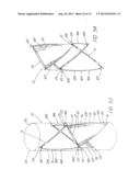 IMPLANTABLE VASCULAR DEVICE diagram and image