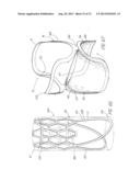 IMPLANTABLE VASCULAR DEVICE diagram and image