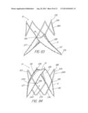 IMPLANTABLE VASCULAR DEVICE diagram and image