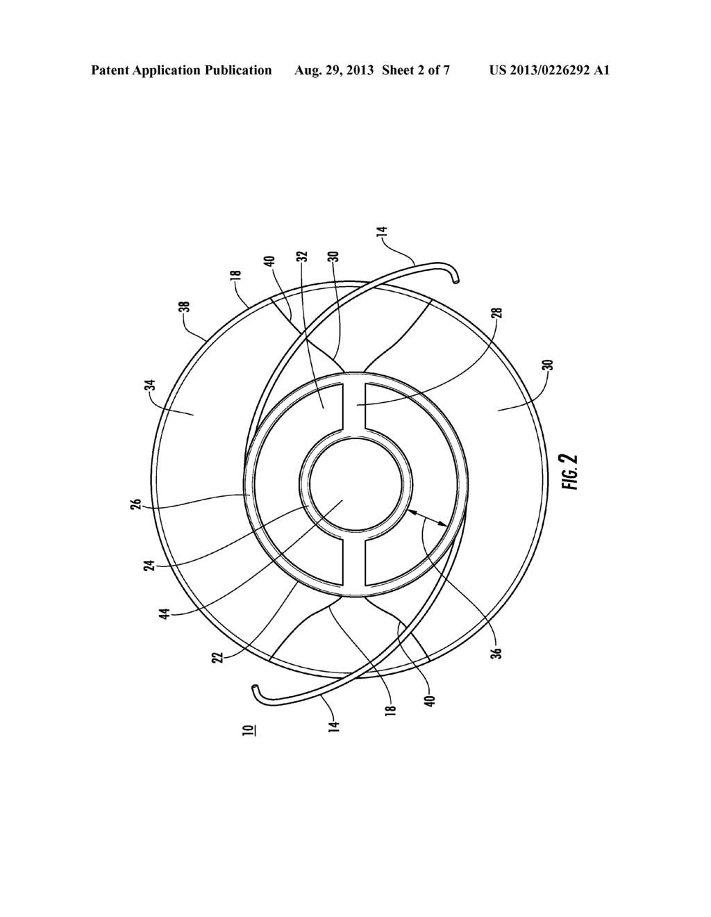 ISLET STORING INTRAOCULAR IMPLANT, METHOD OF USING THE SAME AND KIT     INCLUDING THE SAME - diagram, schematic, and image 03