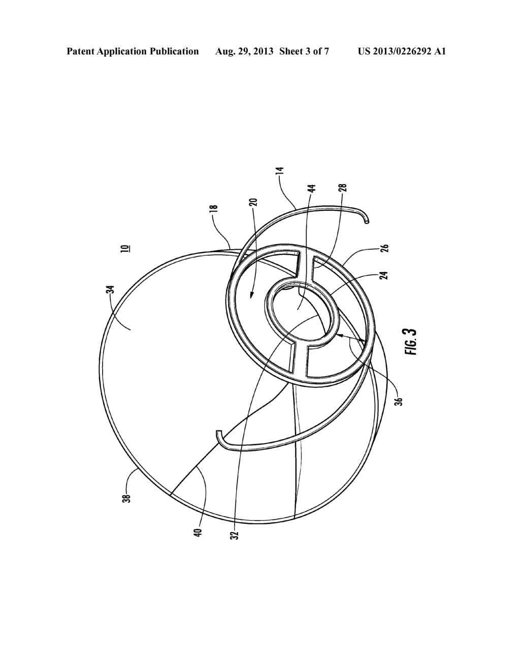 ISLET STORING INTRAOCULAR IMPLANT, METHOD OF USING THE SAME AND KIT     INCLUDING THE SAME - diagram, schematic, and image 04