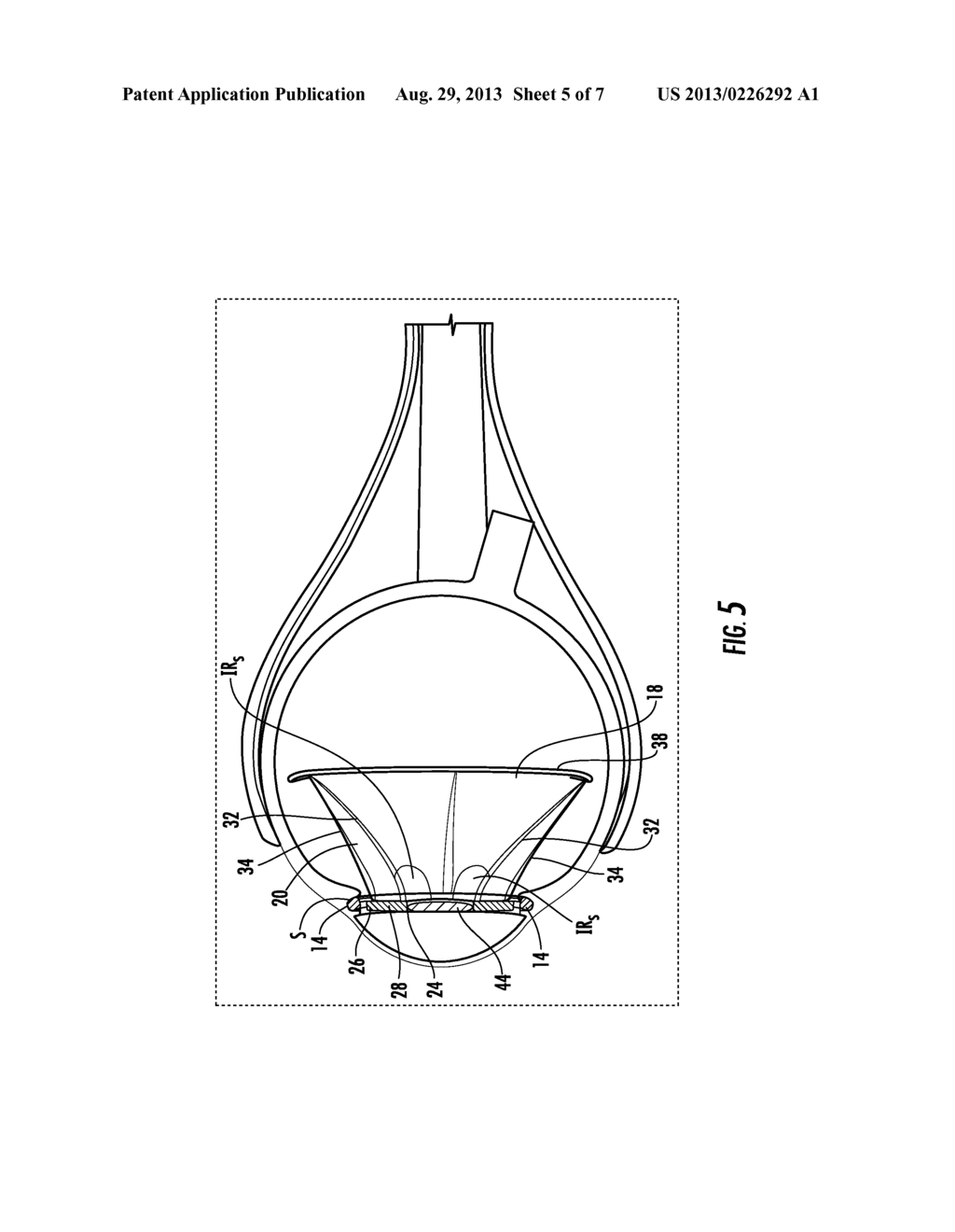 ISLET STORING INTRAOCULAR IMPLANT, METHOD OF USING THE SAME AND KIT     INCLUDING THE SAME - diagram, schematic, and image 06