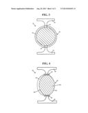 ACCOMMODATIVE IOL - REFRACTIVE INDEX CHANGE THROUGH CHANGE IN     POLARIZABILITY OF A MEDIUM diagram and image