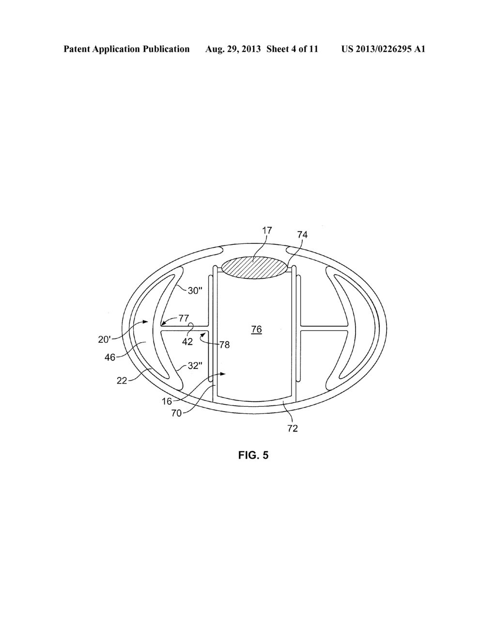 Intraocular, Accommodating Lens And Methods Of Use - diagram, schematic, and image 05