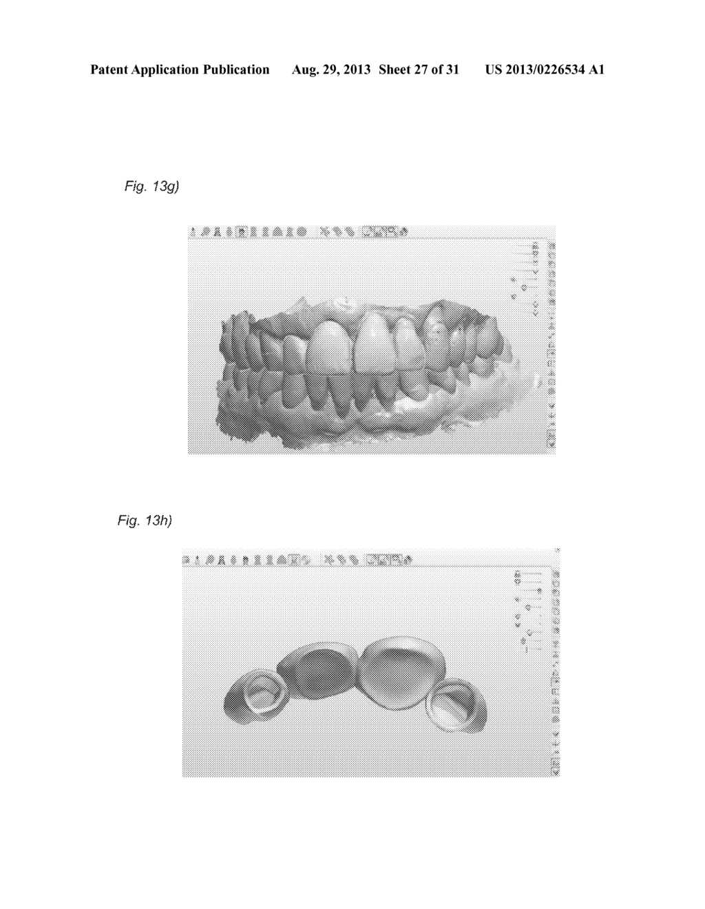 DESIGNING A VIRTUAL PREPARATION AND A VIRTUAL GINGIVAL - diagram, schematic, and image 28