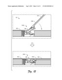 Device Kickstand diagram and image