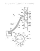 INSTRUMENT-ACTIVATED SUB-SURFACE COMPUTER BUTTONS AND SYSTEM AND METHOD     INCORPORATING SAME diagram and image