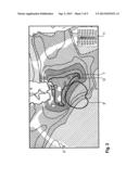 Flexible Computation of Isodose Lines diagram and image