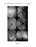 Enhanced Sensitivity Line Field Detection diagram and image