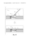 Device Kickstand diagram and image