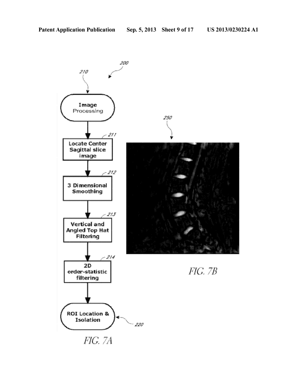 SYSTEMS AND METHODS FOR AUTOMATED VOXELATION OF REGIONS OF INTEREST FOR     MAGNETIC RESONANCE SPECTROSCOPY - diagram, schematic, and image 10