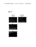 Method and system for analyzing lip conditions using digital images diagram and image