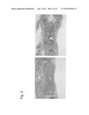 PHARMACEUTICAL COMPOSITION FOR TREATING BONE DISEASES WHICH COMPRISES     PROTEIN COMPRISING FRIZZLED1, FRIZZLED2 OR FRIZZLED7 EXTRACELLULAR     CYSTEINE-RICH DOMAIN diagram and image