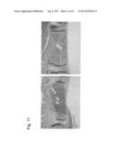 PHARMACEUTICAL COMPOSITION FOR TREATING BONE DISEASES WHICH COMPRISES     PROTEIN COMPRISING FRIZZLED1, FRIZZLED2 OR FRIZZLED7 EXTRACELLULAR     CYSTEINE-RICH DOMAIN diagram and image