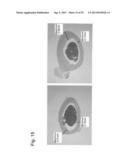 PHARMACEUTICAL COMPOSITION FOR TREATING BONE DISEASES WHICH COMPRISES     PROTEIN COMPRISING FRIZZLED1, FRIZZLED2 OR FRIZZLED7 EXTRACELLULAR     CYSTEINE-RICH DOMAIN diagram and image