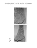 PHARMACEUTICAL COMPOSITION FOR TREATING BONE DISEASES WHICH COMPRISES     PROTEIN COMPRISING FRIZZLED1, FRIZZLED2 OR FRIZZLED7 EXTRACELLULAR     CYSTEINE-RICH DOMAIN diagram and image