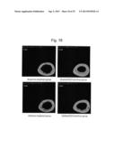 PHARMACEUTICAL COMPOSITION FOR TREATING BONE DISEASES WHICH COMPRISES     PROTEIN COMPRISING FRIZZLED1, FRIZZLED2 OR FRIZZLED7 EXTRACELLULAR     CYSTEINE-RICH DOMAIN diagram and image